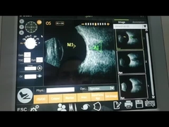 Hohe super axiale Entschließung der IOL-Berechnungs-Funktions-Ultraschallscanner-Maschinen-10MHz