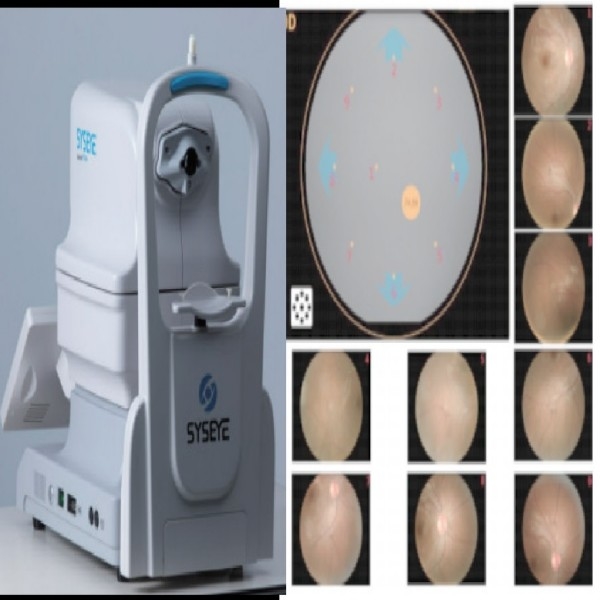 Tragbare Netzhautkamera ohne Mydriatik mit 2,8 mm Pupille DICOM & AI manueller Fokussierung