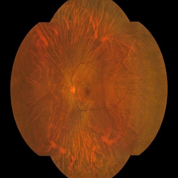 8 μm optische Auflösung Wide-Field-Fundus-Kamera mit 27-Zoll-HD-Farbmonitor und automatischem Fokus