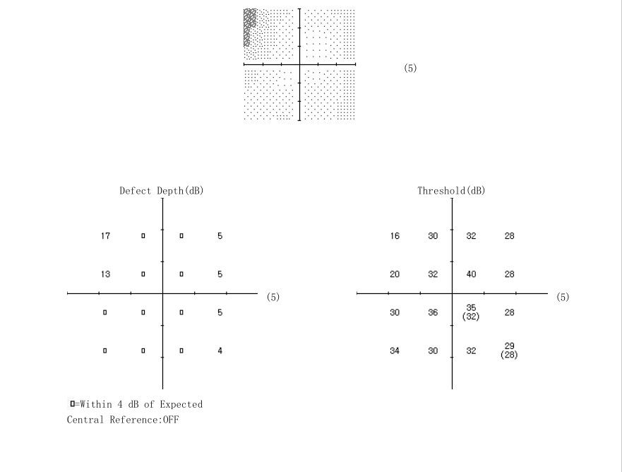 Sicherungs-Art automatisierte mehrfache Berichts-Analyse der Perimetry-Test-Maschinen-240V