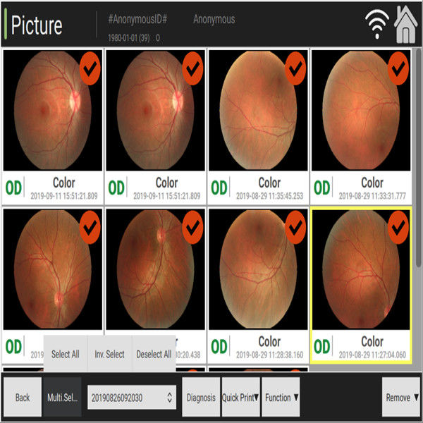 3.3mm automatisierte Fundus-Kamera, Farbänderung der Sehnerv-Atrophie beobachtend